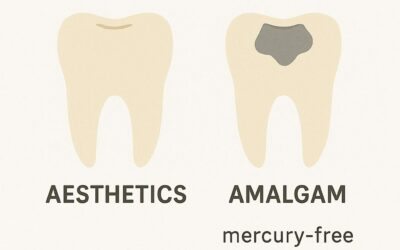 Why Choose Composite Over Amalgam?